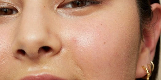 How to minimize pores