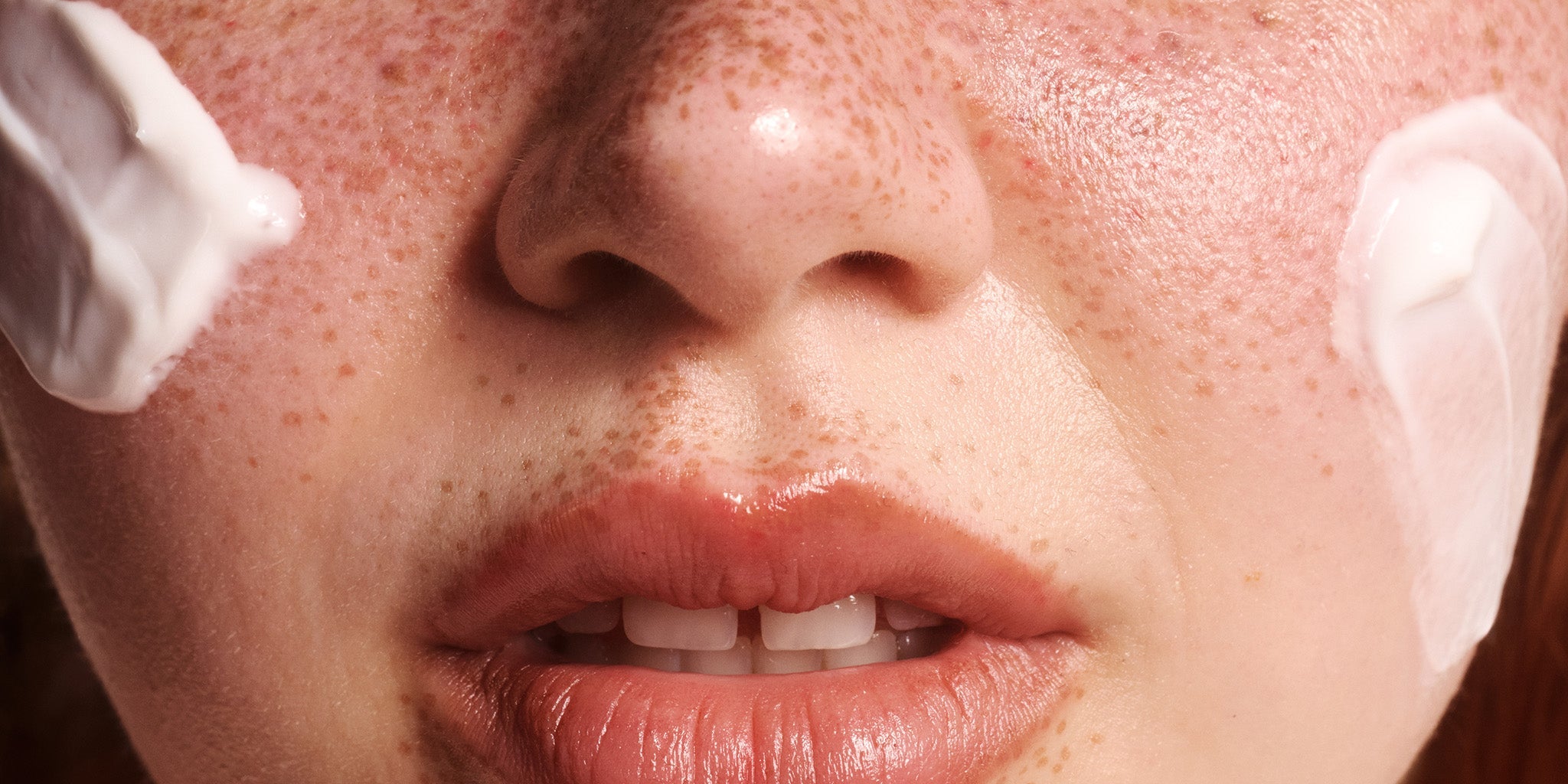 Close-up of a person's face with The Body Shop Vitamin E Day Cream on their cheeks and chin.