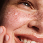 Close-up of a person's face with freckles, with two drops of The Body Shop Tea Tree Oil on their cheek